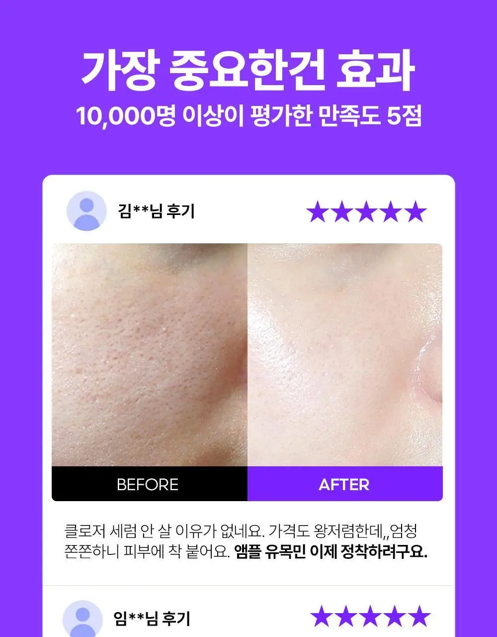 [모공임상] 프랭클리 모공축소 클로저 세럼 30ml 앰플 상세페이지 24